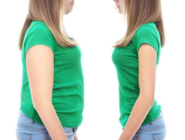 The Different Types Of Weight Loss Surgery